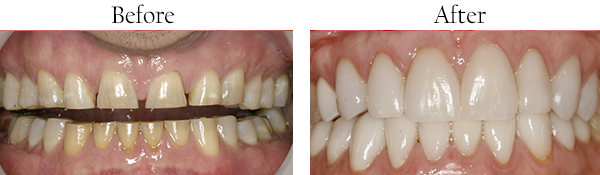Middlesex Dental Images