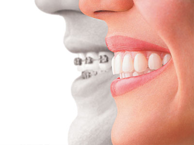 Amaltas Dental Implant Center | Extractions, Root Canals and Sleep Apnea